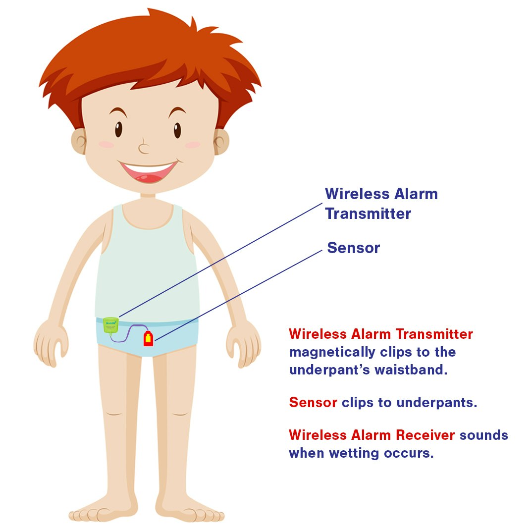 Malem Wireless Bedwetting Alarm Diagram