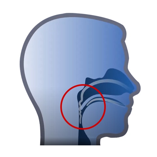 Obstructed Airway