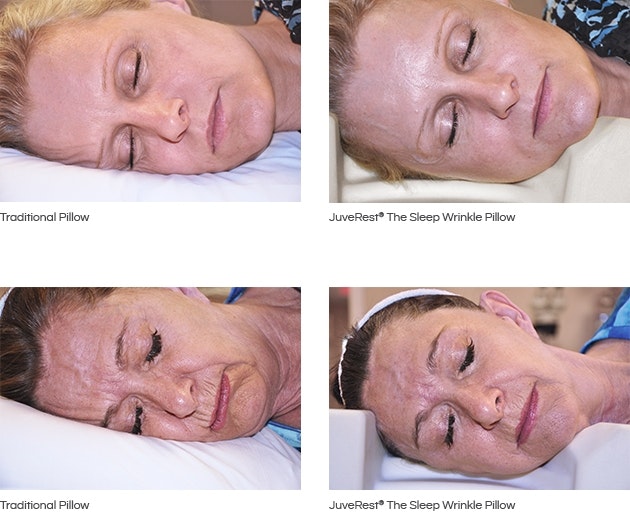 See the Difference with Juverest The Sleep Wrinkle Pillow